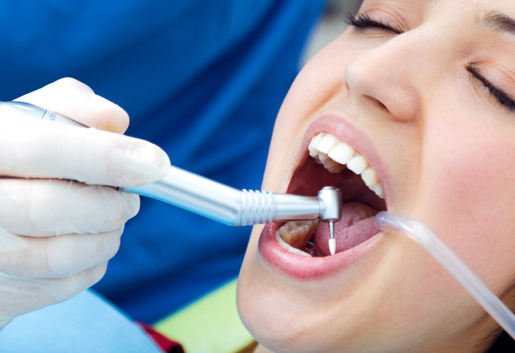 Root Canal Treatment in Anand