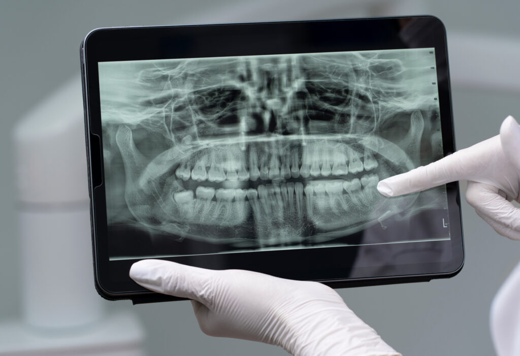Routine Dental Examinations and X-Rays